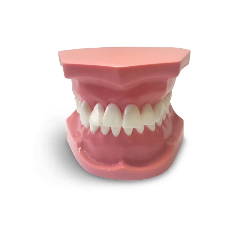 ORB03 – ортодонтическая модель с брекетами и твердой десной, 2 класс | GF Dental (Италия)