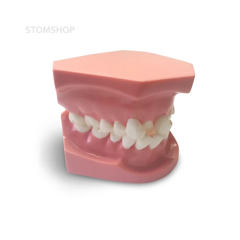 ORB02 – ортодонтическая модель с брекетами и твердой десной, 1 класс | GF Dental (Италия)