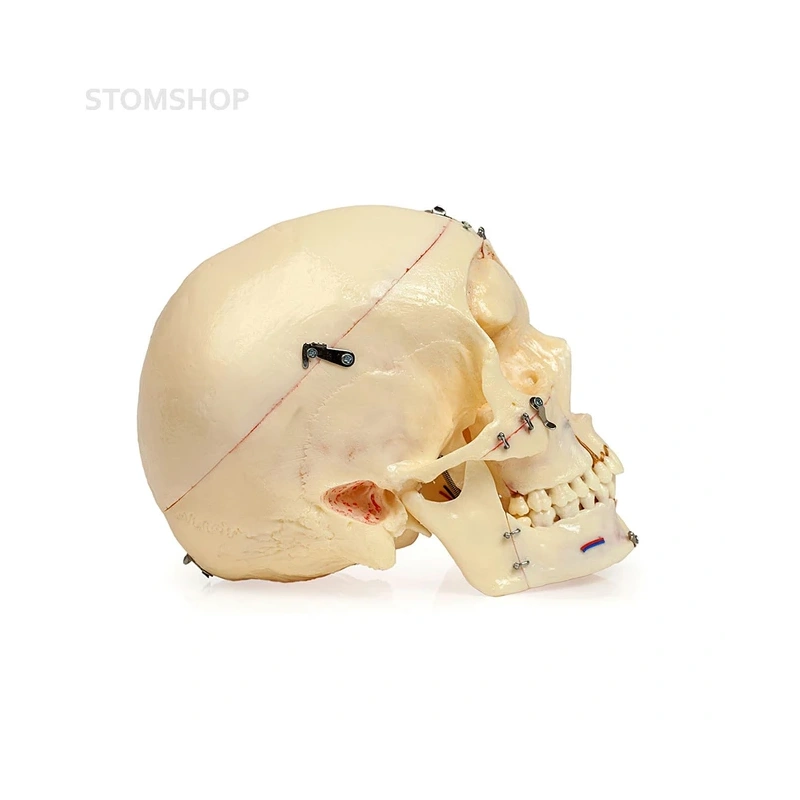 Демонстрационная модель черепа, состоящая из 10 частей | Dentalstore (Италия)