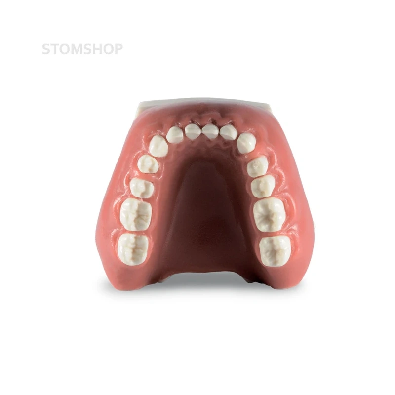 Модель верхней и нижней челюсти для отработки навыков закрытия рецессии | Dentalstore (Италия)