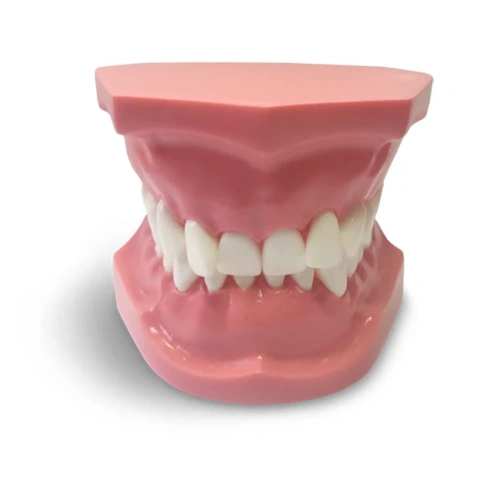 ORB06 – ортодонтическая модель с брекетами и твердой десной, 2 класс | GF Dental (Италия)