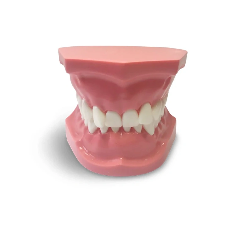 ORB06 – ортодонтическая модель с брекетами и твердой десной, 2 класс | GF Dental (Италия)