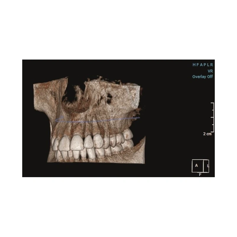 KaVo Pan eXam Plus 3D Ceph - универсальный датчик Pan/Ceph для панорамной томографии, цефалостат, функция 3D-томографии 6x8 см | KaVo (Германия)