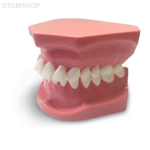 ORB03 – ортодонтическая модель с брекетами и твердой десной, 2 класс | GF Dental (Италия)