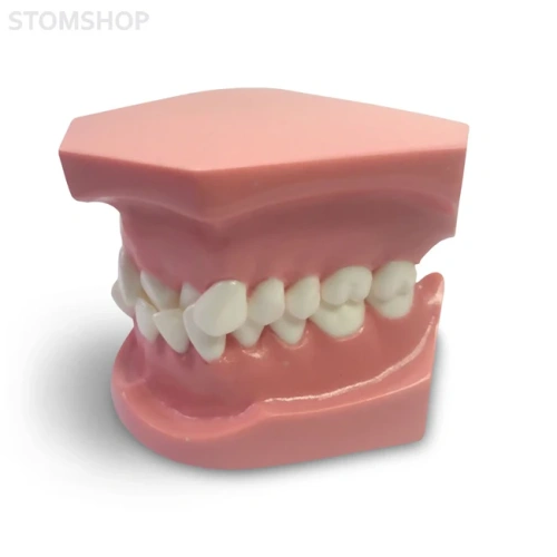ORB02 – ортодонтическая модель с брекетами и твердой десной, 1 класс | GF Dental (Италия)