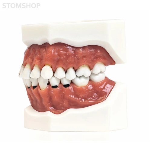 Модель верхней и нижней челюсти с различными патологиями | Dentalstore (Италия)
