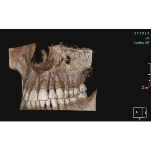 KaVo Pan eXam Plus 3D - цифровая панорамная рентгенодиагностическая система с функцией 3D-томографии 6x8 см и возможностью дооснащения модулем цефалостата | KaVo (Германия)