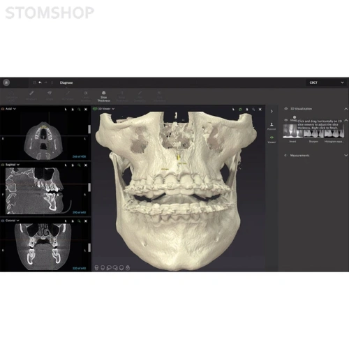 OP 3D Vision - аппарат панорамный рентгеновский стоматологический с функцией томографии | KaVo (Германия)