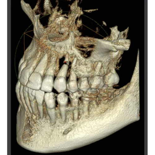 RAYSCAN Symphony Alpha OCL – ортопантомограф c цефалостатом (One Shot), 33х33 см | Ray Co., Ltd. (Ю. Корея)