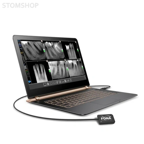 Комплект Xelium Ultra PD и Fona StarX PRO - низкочастотный портативный дентальный рентген с визиографом