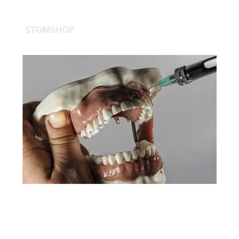 Модель челюсти для практики проведения местной анестезии | Dentalstore (Италия)