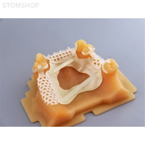 Gorky Liquid Dental Castable LCD/DLP - фотополимерная смола для прямой отливки зубных имплантатов, цвет полупрозрачный, 1 кг | Gorky Liquid (Россия)