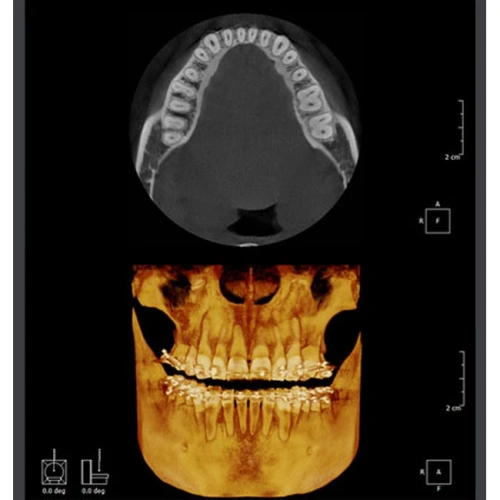 RAYSCAN Symphony Alpha M3DL – томограф 3 в 1: ортопантомограф и цефалостат (OneShot) 33х33 см, компьютерный томограф 3D 9х9 см | Ray Co., Ltd. (Ю. Корея)