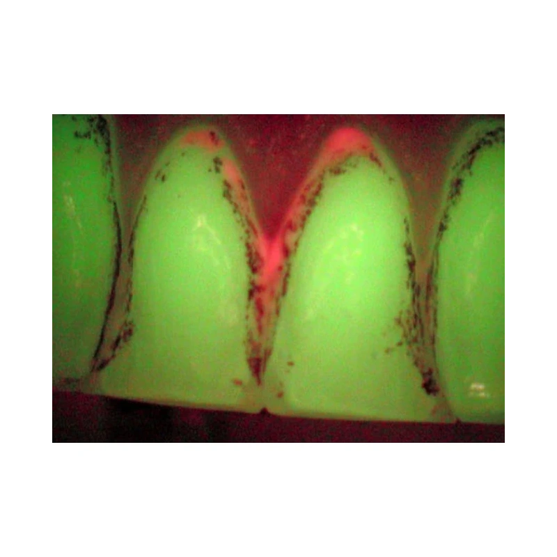 VistaCam IX - интраоральная видеокамера, подключается к USB ПК, с насадками Cam, Proxi | D?rr Dental (Германия)