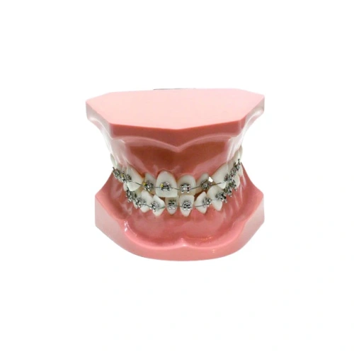 ORB02 – ортодонтическая модель с брекетами и твердой десной, 1 класс | GF Dental (Италия)