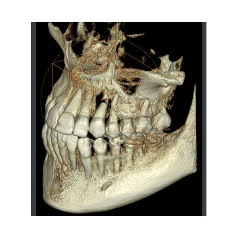 RAYSCAN Symphony Alpha SM3D – томограф 3 в 1: ортопантомограф и цефалостат 26х24 см, компьютерный томограф 3D 9х9 см | Ray Co., Ltd. (Ю. Корея)