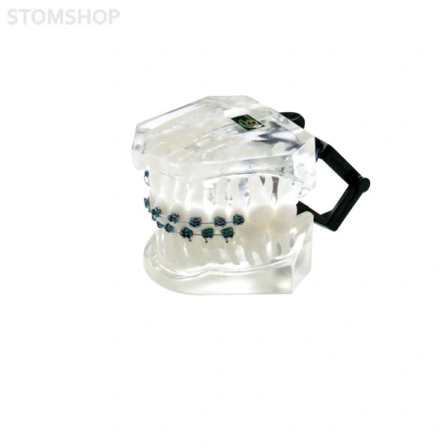 OTB5 – прозрачная ортодонтическая модель с брекетами и твердой десной | GF Dental (Италия)
