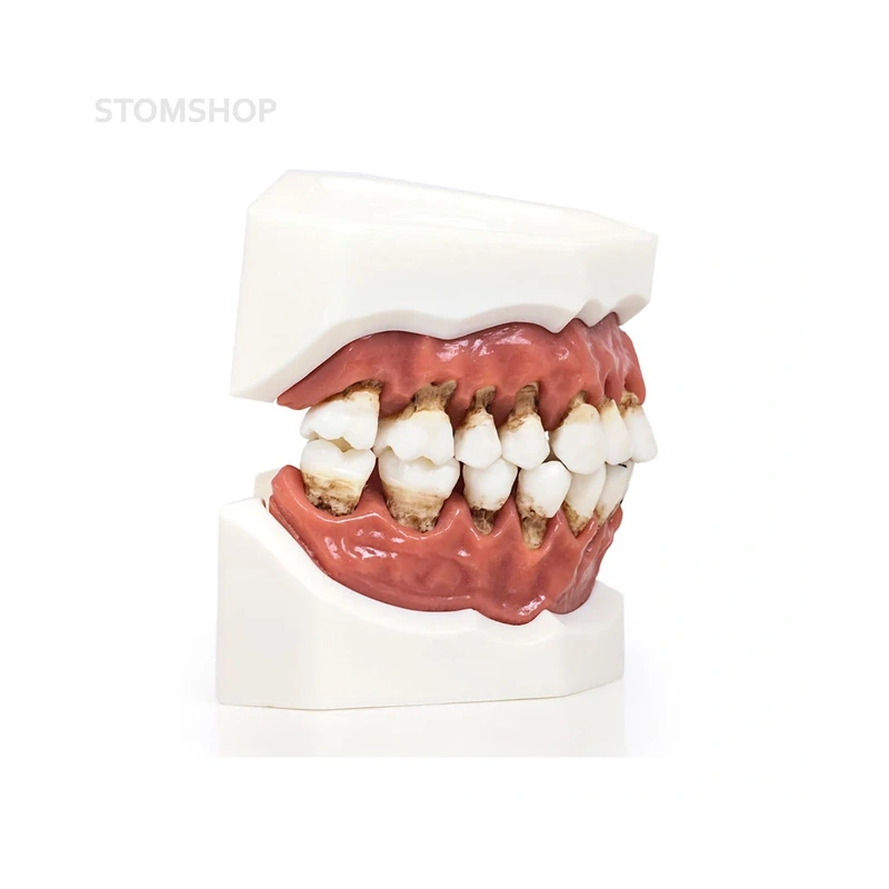 Модель верхней и нижней челюсти с различными патологиями | Dentalstore (Италия)