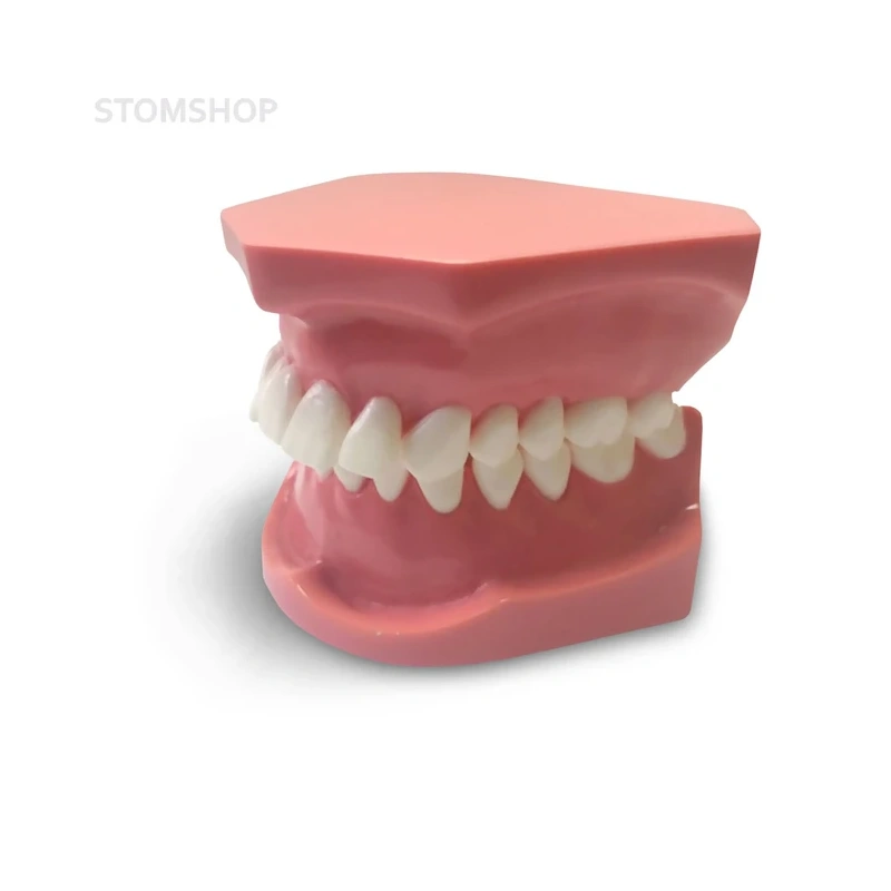 ORB03 – ортодонтическая модель с брекетами и твердой десной, 2 класс | GF Dental (Италия)