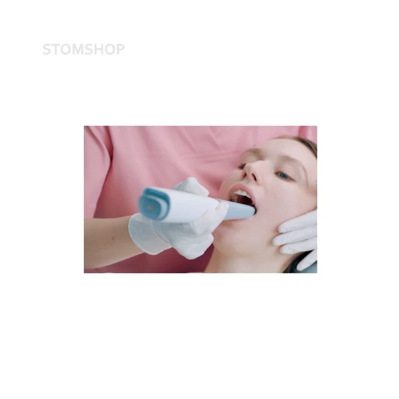 Aoralscan 3 Wireless - беспроводной интраоральный сканер | Shining 3D (Китай)