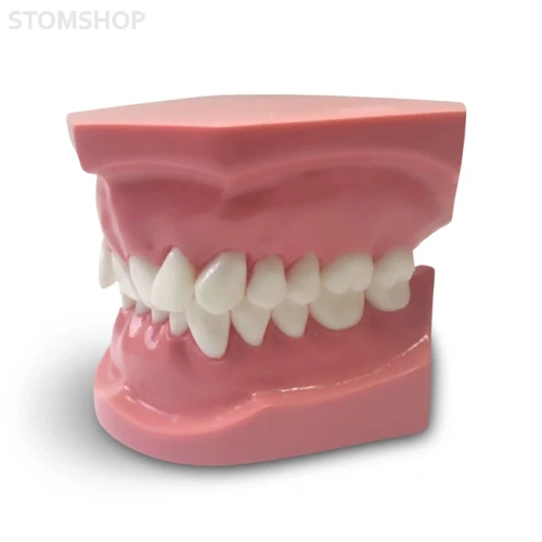 ORB06 – ортодонтическая модель с брекетами и твердой десной, 2 класс | GF Dental (Италия)