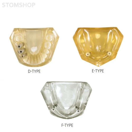 CRYSTAL IMPLANT MODEL - модель для демонстрации установки имплантатов | Hanil (Ю. Корея)