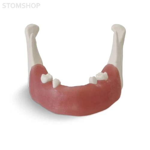 E82 – модель нижней челюсти для практики установки имплантатов | GF Dental (Италия)
