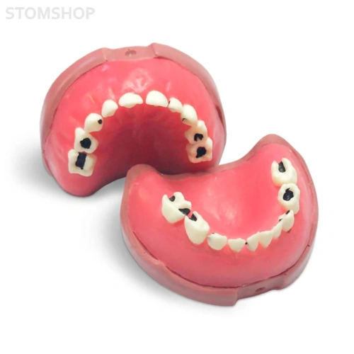 EK5 – модель верхней и нижней детской челюсти для практики | GF Dental (Италия)